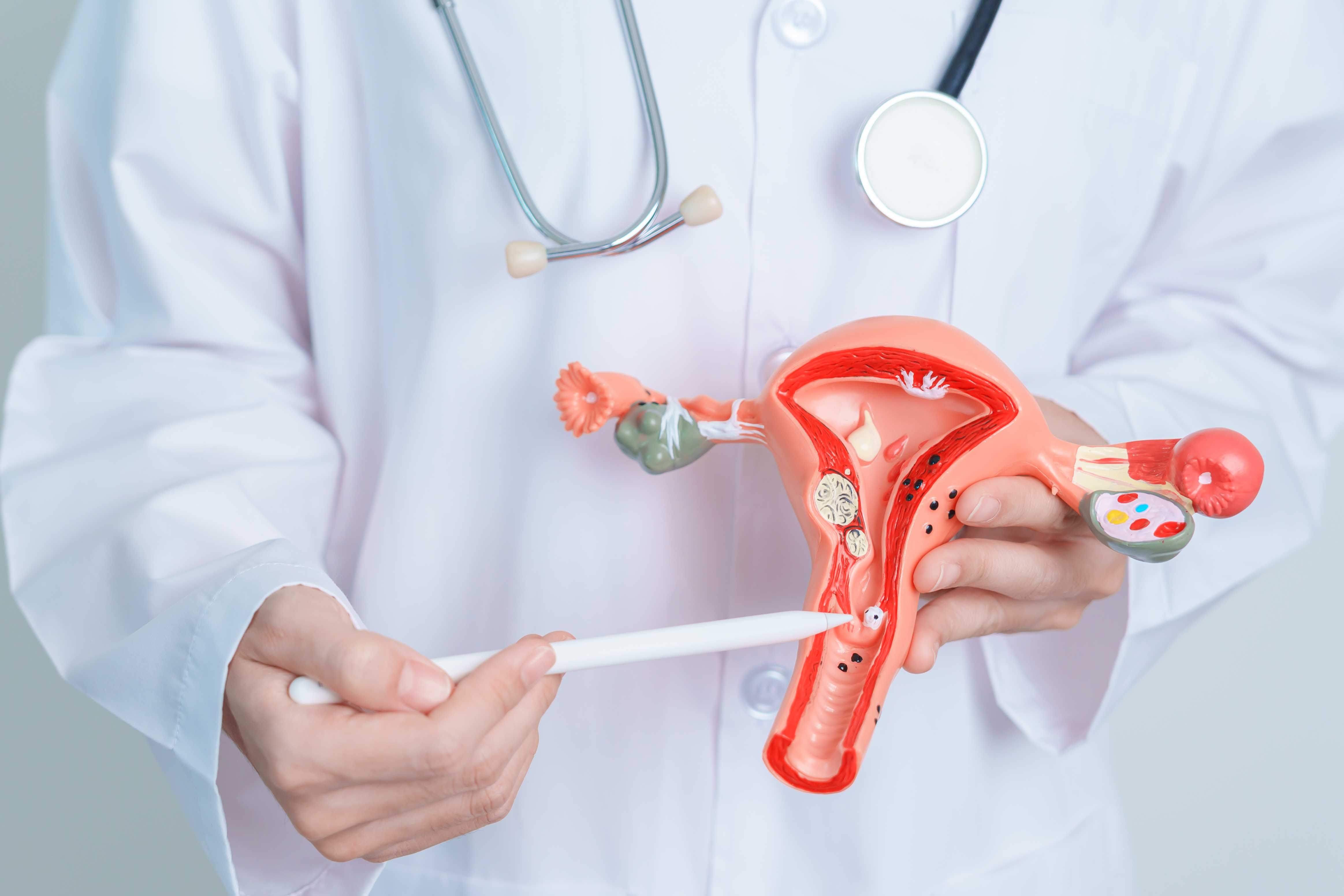 Gynecological Oncology1