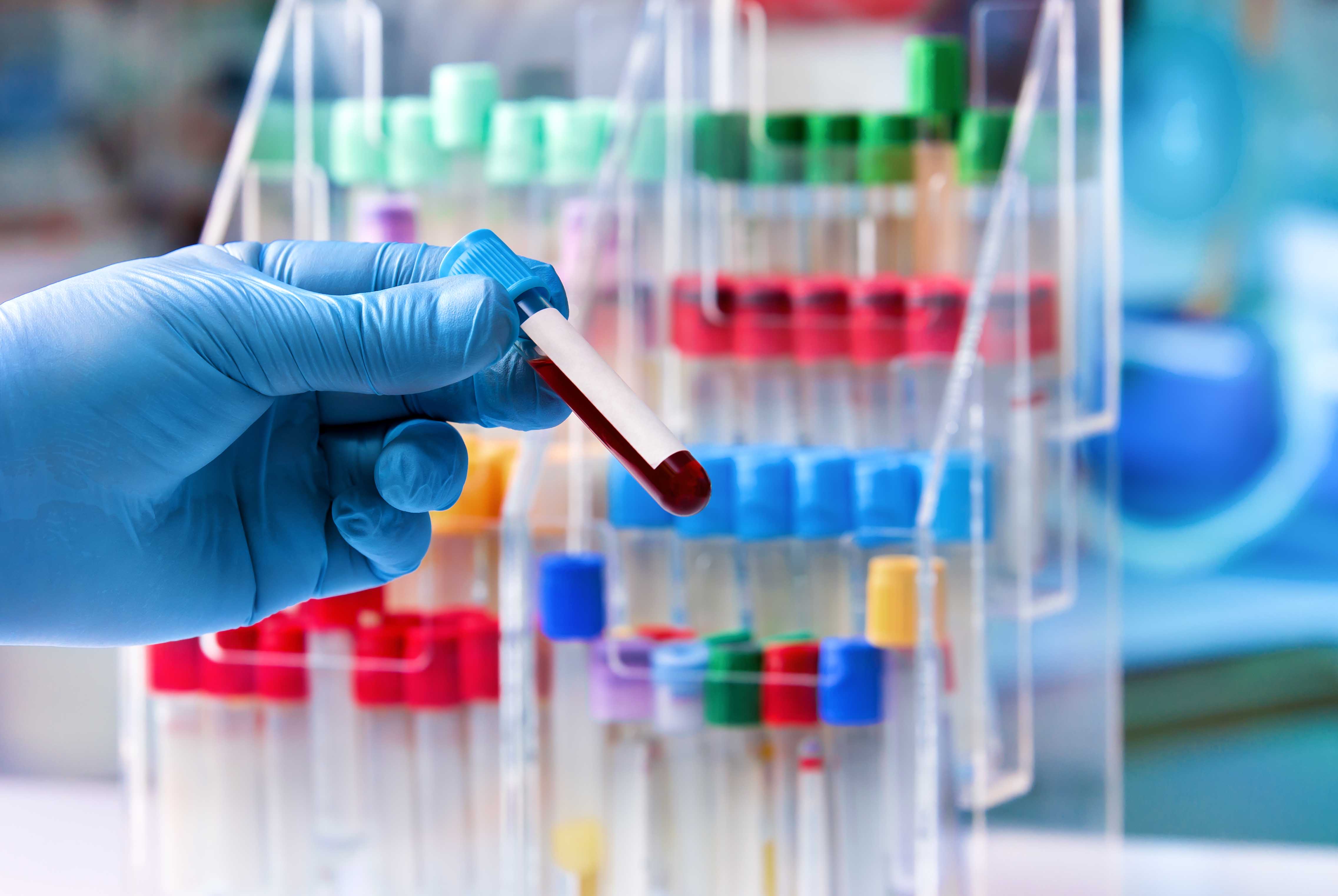 Hematological Pathology1