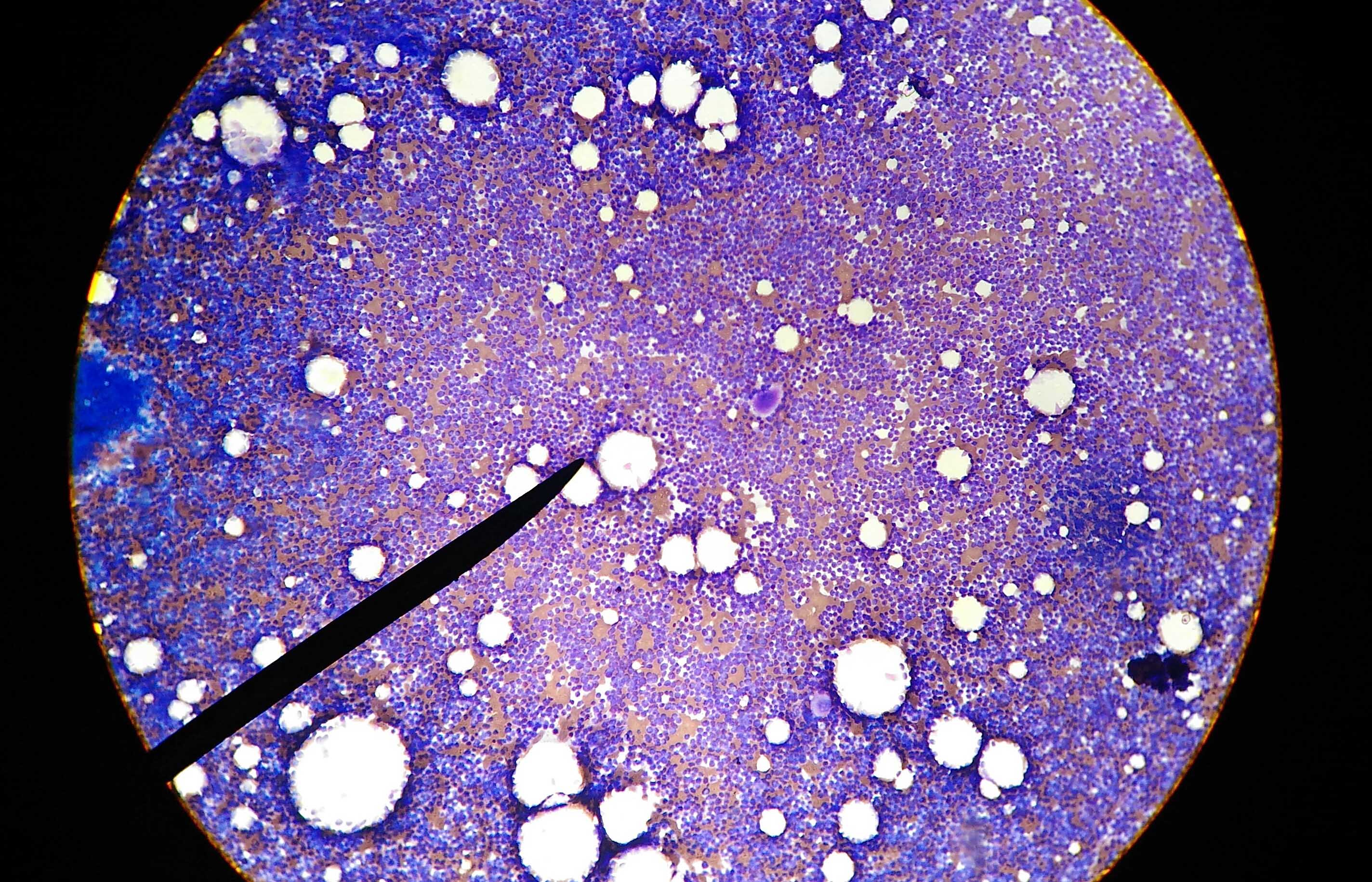 Hematopoietic Stem Cell Transplantation1