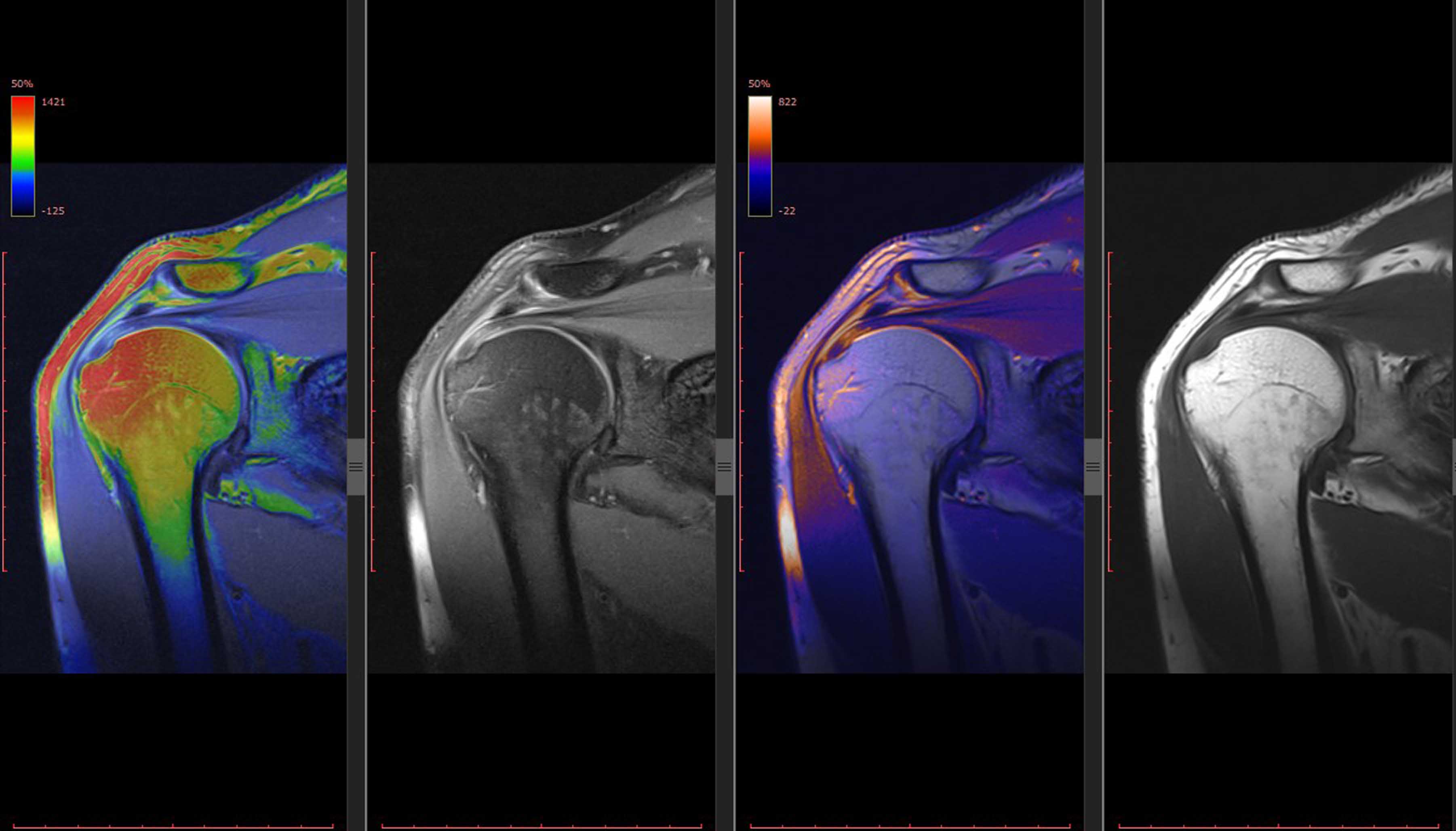 Musculoskeletal Imaging Musculoskeletal Imaging1