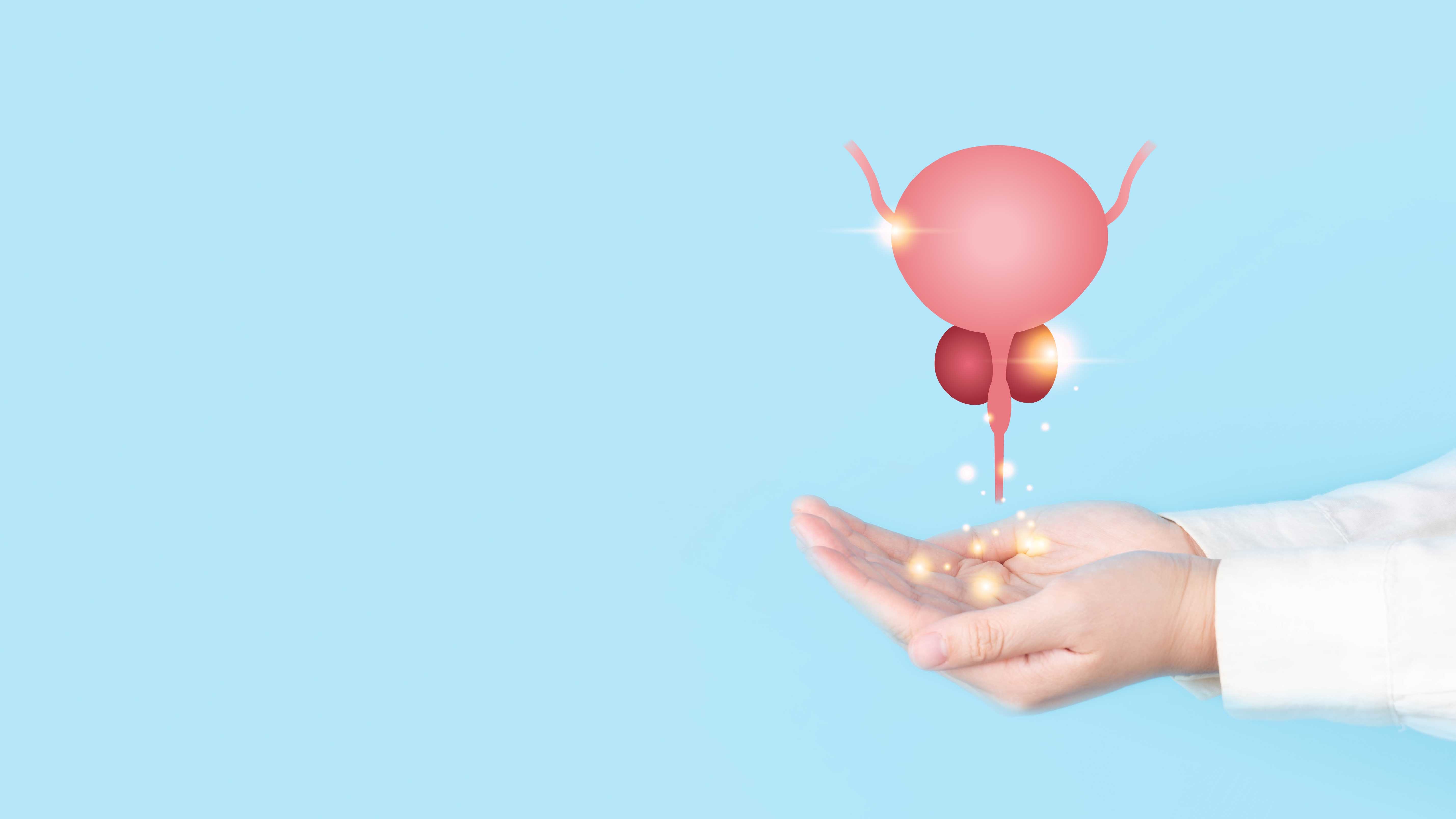 Urological Oncology1