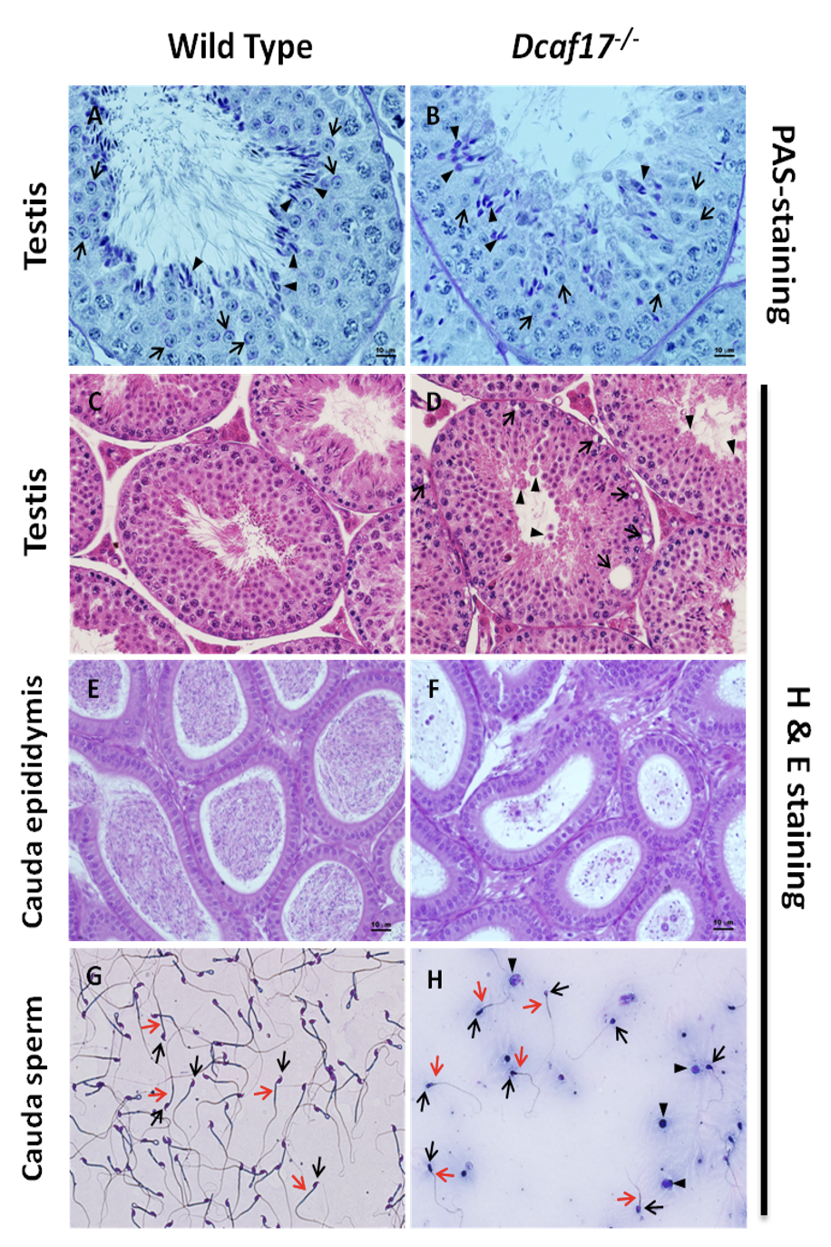 Fgure01 Investigating the Role of Dcaf17 Gene in Mice Spermatogenesis