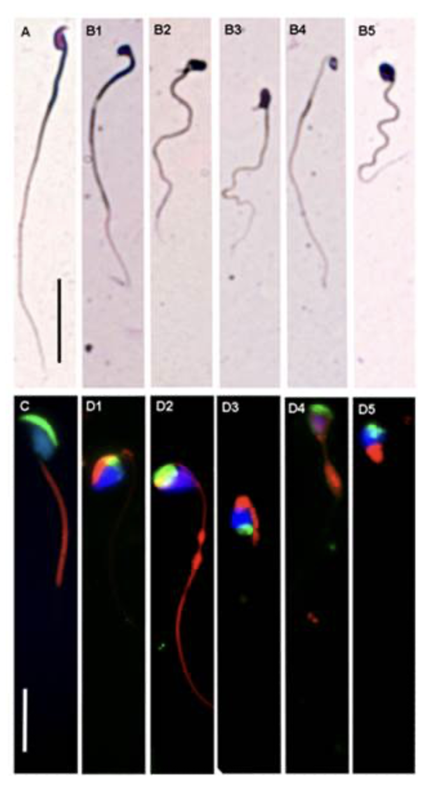 Figure02 Investigating the Role of Dcaf17 Gene in Mice Spermatogenesis